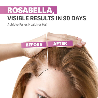 Rosabella™ Viral Hair Growth Gummies (Limited Time Offer)